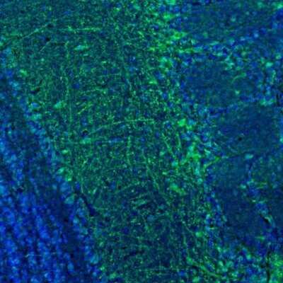 Immunohistochemistry: C21orf59 Antibody [NBP1-88275]