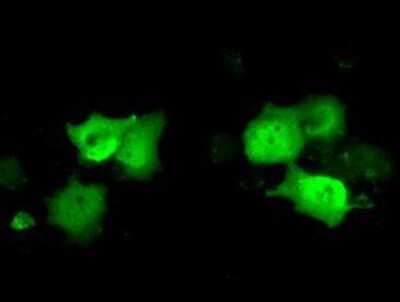 Immunocytochemistry/ Immunofluorescence: C21orf59 Antibody (OTI2H5) - Azide and BSA Free [NBP2-72060]