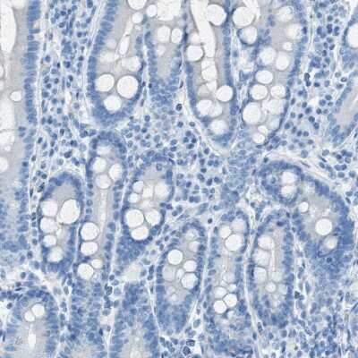 Immunohistochemistry-Paraffin: C21orf62 Antibody [NBP1-88947]