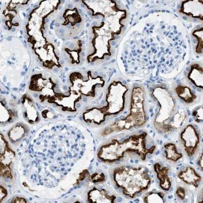 Immunohistochemistry-Paraffin: C21orf62 Antibody [NBP1-88947]