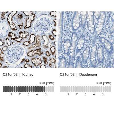 Immunohistochemistry-Paraffin: C21orf62 Antibody [NBP1-88947]