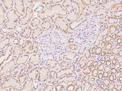 Immunohistochemistry-Paraffin: C21orf62 Antibody [NBP3-06003]