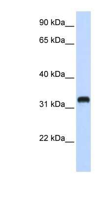 Western Blot: C21orf62 Antibody [NBP1-80554]