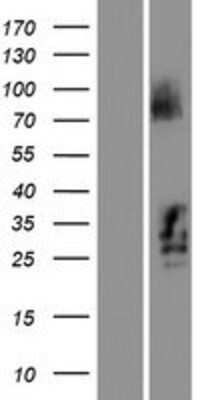 Western Blot: C21orf62 Overexpression Lysate [NBL1-08389]