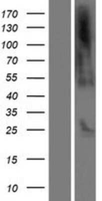 Western Blot: C21orf62 Overexpression Lysate [NBP2-10182]