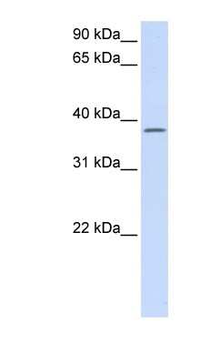Western Blot: C21orf91 Antibody [NBP1-56401]