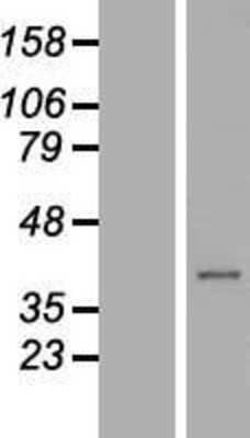Western Blot: C21orf91 Overexpression Lysate [NBL1-08391]