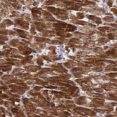 Immunohistochemistry-Paraffin: Protein Bop Antibody [NBP1-93956]