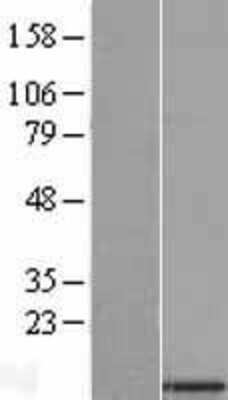 Western Blot: SMDT1 Overexpression Lysate [NBL1-08397]