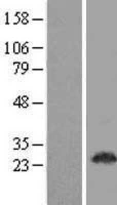 Western Blot: TEX33 Overexpression Lysate [NBL1-08398]