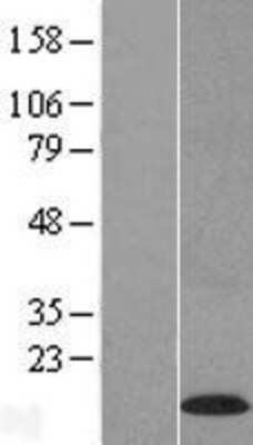 Western Blot: C22orf39 Overexpression Lysate [NBL1-08399]