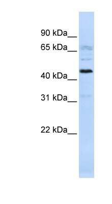 Western Blot: C22orf9 Antibody [NBP1-70465]