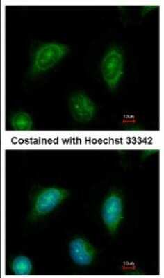 Immunocytochemistry/ Immunofluorescence: C2CD2 Antibody [NBP2-15647]