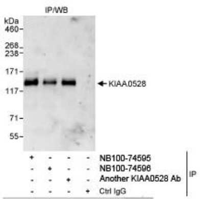 Immunoprecipitation: C2CD5 Antibody [NB100-74595]