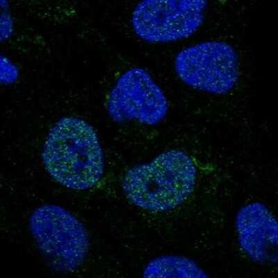 Immunocytochemistry/ Immunofluorescence: C2GNT3 Antibody [NBP1-88270]