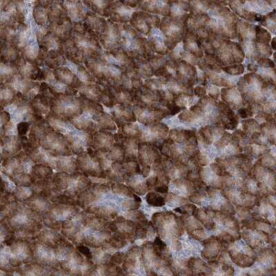Immunohistochemistry-Paraffin: C2GNT3 Antibody [NBP1-88270]