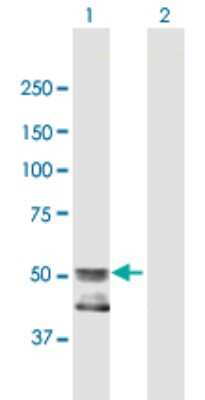 Western Blot: C2GNT3 Antibody [H00051301-B01P]