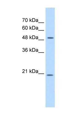 Western Blot: C2GNT3 Antibody [NBP1-69591]