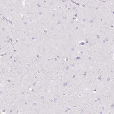 Immunohistochemistry-Paraffin: D-Glutamate Cyclase Antibody [NBP2-30715]