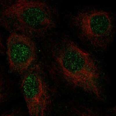 Immunocytochemistry/ Immunofluorescence: C2orf42 Antibody [NBP2-58034]