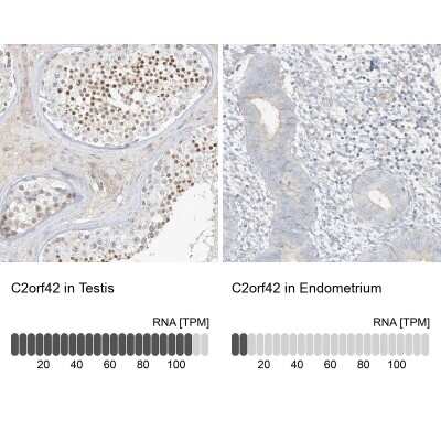 Immunohistochemistry-Paraffin: C2orf42 Antibody [NBP2-48620]