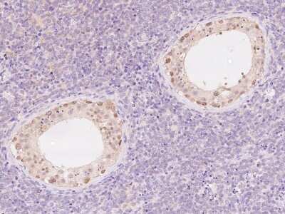 Immunohistochemistry-Paraffin: C2orf42 Antibody [NBP2-97391]