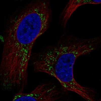 Immunocytochemistry/ Immunofluorescence: MAIP1 Antibody [NBP2-56654]