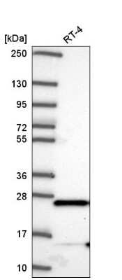 Western Blot: MAIP1 Antibody [NBP2-56654]