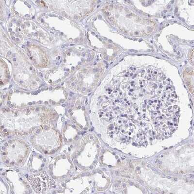 Immunohistochemistry-Paraffin: TEX44 Antibody [NBP2-49226]