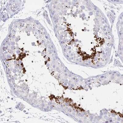 Immunohistochemistry-Paraffin: TEX44 Antibody [NBP2-49226]