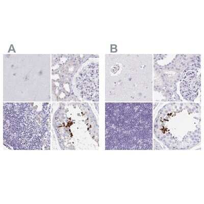 Immunohistochemistry-Paraffin: TEX44 Antibody [NBP2-49226]