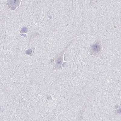 Immunohistochemistry-Paraffin: TEX44 Antibody [NBP2-49226]