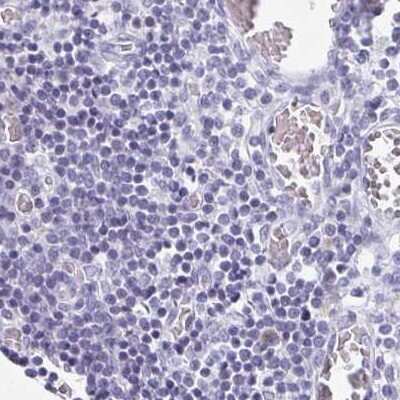 Immunohistochemistry-Paraffin: TEX44 Antibody [NBP2-49226]