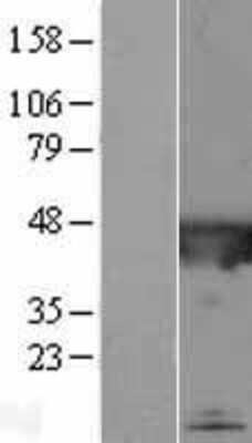 Western Blot: CATIP Overexpression Lysate [NBL1-08424]