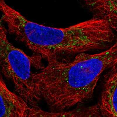 Immunocytochemistry/ Immunofluorescence: M1AP Antibody [NBP2-57175]
