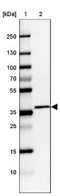 Western Blot: C2orf72 Antibody [NBP1-93551]