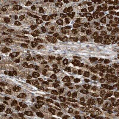 Immunohistochemistry-Paraffin: C2orf74 Antibody [NBP1-93548]