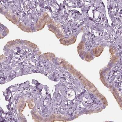 Immunohistochemistry-Paraffin: C2orf81 Antibody [NBP2-58395]