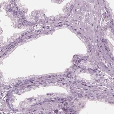 Immunohistochemistry-Paraffin: C2orf81 Antibody [NBP2-58395]