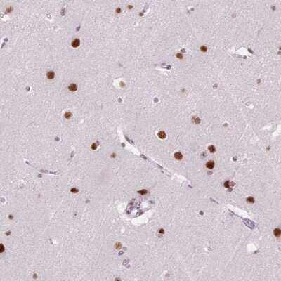 Immunohistochemistry-Paraffin: SNORC Antibody [NBP2-30862]