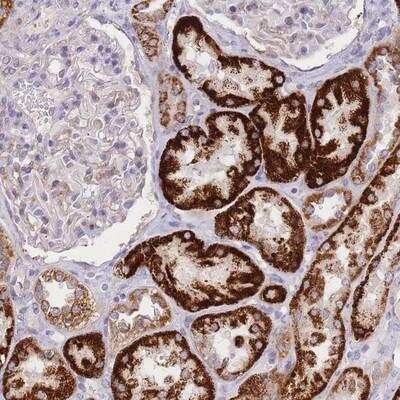 Immunohistochemistry-Paraffin: C2orf88 Antibody [NBP2-14407]