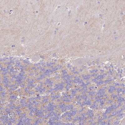 Immunohistochemistry-Paraffin: C2orf88 Antibody [NBP2-14407]