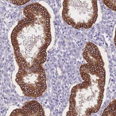 Immunohistochemistry-Paraffin: C2orf88 Antibody [NBP2-14407]