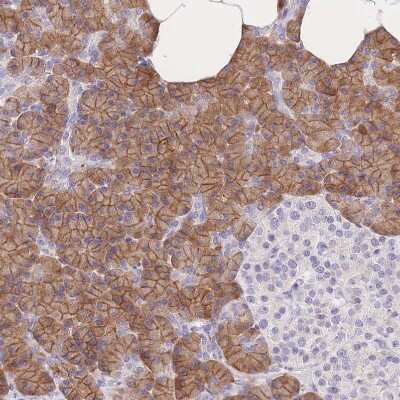 Immunohistochemistry-Paraffin: C2orf88 Antibody [NBP2-14407]