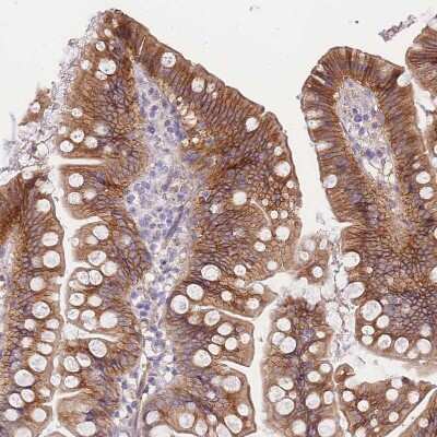 Immunohistochemistry-Paraffin: C2orf88 Antibody [NBP2-14407]