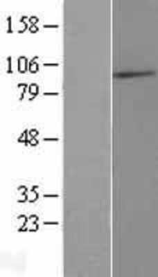 Western Blot: MAATS1 Overexpression Lysate [NBP2-05885]