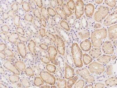 Immunohistochemistry: C3orf18 Antibody [NBP3-05955]