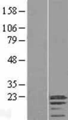 Western Blot: C3orf18 Overexpression Lysate [NBL1-08435]