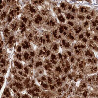 Immunohistochemistry-Paraffin: CCDC174 Antibody [NBP2-14409]