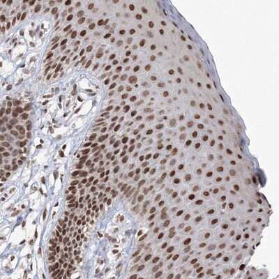 Immunohistochemistry-Paraffin: C3orf33 Antibody [NBP1-90874]